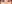 裏ハムラ法（経結膜的眼窩脂肪移動術） — ウィバース美容外科クリニック