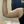 Arm liposuction — before (1days) · Model Line Clinic - Gangnam Branch