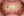 Metal bracket braces (traditional fixed orthodontics) — before (123days) · Yeonse Bareun Dental Clinic