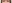 頬の脂肪吸引 — ファクト美容外科クリニック