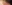 頬の脂肪吸引 — ユーキャンビー美容外科クリニック