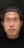 InMode Body (RF กระชับสัดส่วน/ลดไขมันลำตัว) — ก่อนทำ (30วัน) · เนล คลินิก