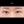 ผ่าตัดแก้ขนตาทิ่มตา (ขนตาแยงตา / เปลือกตาม้วนเข้า) — ก่อนทำ (30วัน) · รพ.ศัลยกรรมตกแต่งโอลโล