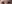 眉毛挙上術（ブロウリフト） — エイペックス美容外科クリニック