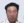 Scalp hair transplant — after (2days) · Okgeon Hairline Clinic