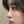 ผ่าตัดเอาสิ่งแปลกปลอมออกจากจมูก (เอาซิลิโคนจมูกออก) — หลังทำ (14วัน) · ไฮบอม ศัลยกรรมพลาสติก