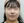 ฟิลเลอร์ติ่งหู (เสริมติ่งหู / หูมงคล) — ก่อนทำ · คลินิกยูพิค สาขาซองโด