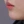 Full-face filler (full-face HA rejuvenation) — after · U&I Clinic - Yeongdeungpo Branch