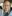 Facial fat grafting (autologous fat transfer to the face) — Pleasure Plastic Surgery Clinic