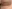 豊胸術（シリコンインプラント／人工乳腺） — SM美容外科クリニック