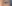 PRP併用の自家脂肪注入（脂肪移植＋多血小板血漿） — オメガ美容外科クリニック