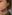 Juvelook (PDLLA + HA collagen-stimulating skin booster) — Seoul Eye Plastic Surgery Clinic