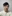 頸闊肌摺疊縫合術（雙下巴緊縮） — Saekim 整形外科診所