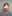 Facelift (rhytidectomy) — DM Plastic Surgery Clinic