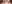 裏ハムラ法（経結膜的眼窩脂肪移動術） — メイト美容外科クリニック