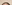 額縮小術（生え際下げ・ヘアライン下降術） — リスペック美容外科クリニック