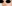 Crooked (deviated) nose rhinoplasty — Coco Line Clinic