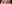 二重まぶた（自然癒着法） — プロミス美容外科クリニック