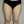 Full-body liposuction — before (21days) · Aurora Clinic