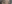 revision eyelid surgery (secondary blepharoplasty) — 1mm Plastic Surgery