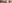 二重まぶた（自然癒着法） — ルホ美容外科クリニック