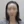 Hairline hair transplant (hairline lowering by grafting) — before (3days) · Vance Mosae Clinic