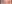 眼瞼下垂手術（目つき矯正） — ルホ美容外科クリニック
