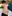 Alar base reduction (alarplasty) — Anersty Plastic Surgery Clinic
