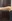 二の腕の脂肪吸引 — ソウル童顔クリニック
