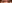 二重まぶた（自然癒着法） — イエロー美容外科クリニック
