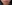 人中短縮（リップリフト） — ドクタータク美容外科クリニック