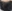 Hairline semi-permanent makeup (hairline micropigmentation / SMP) — TOP Plastic Surgery