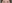 Brow lift — Marvel Plastic Surgery Clinic