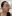 Skin botox (microbotox / intradermal botulinum toxin) — Maison de M Clinic