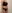 abdominal liposuction — Le Rose Clinic