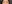 裏ハムラ法（経結膜的眼窩脂肪移動術） — プレジャー美容外科クリニック