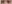 糸リフト（スレッドリフト） — ディユ美容外科クリニック