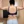 Brachioplasty (arm lift) — after (30days) · The Line Plastic Surgery