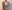 豊胸術（シリコンインプラント／人工乳腺） — バナナ美容外科クリニック