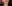 Lip filler (lip augmentation with HA) — Dress Plastic Surgery Clinic