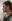 Bulbous nose correction (surgical nasal tip reduction) — Eight Plastic Surgery Clinic