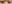 二重まぶた（自然癒着法） — プランナー美容外科クリニック