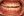 จัดฟันเฉพาะส่วนด้านใน 2D (2D lingual partial braces) — ก่อนทำ (120วัน) · โรงพยาบาล ID - ทันตกรรม