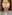 鼻尖形成術（自家軟骨移植） — アナスティ美容外科クリニック