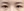 แก้กล้ามเนื้อตาอ่อนแรง — ก่อนทำ (7วัน) · คลินิกศัลยกรรมพลาสติก พ็อพ
