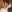 二重まぶた（自然癒着法） — OM美容外科クリニック