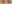 額（おでこ）のヒアルロン酸注入 — フルルン美容外科クリニック