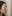 唇のヒアルロン酸注入（リップヒアルロン酸） — ロリポップ美容外科クリニック
