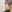小鼻縮小術 — コード美容外科クリニック