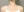 เลเซอร์สลายไขมันต้นขา — หลังทำ (60วัน) · คลินิกหมอซนยูนา